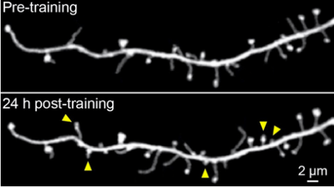 Neuron growth